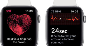 Apple Watch EKG Çekme Özelliği watchOS 5.2