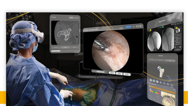 adsız tasarım-43 Apple Vision Pro ameliyat